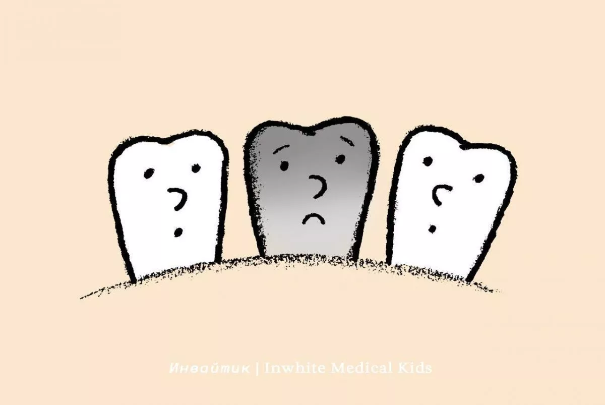 Почему у ребёнка может потемнеть зуб?
