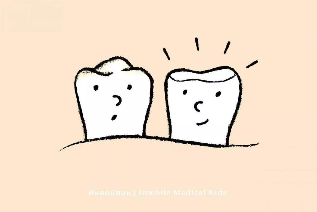 В чём отличие между художественной реставрацией и пломбой?