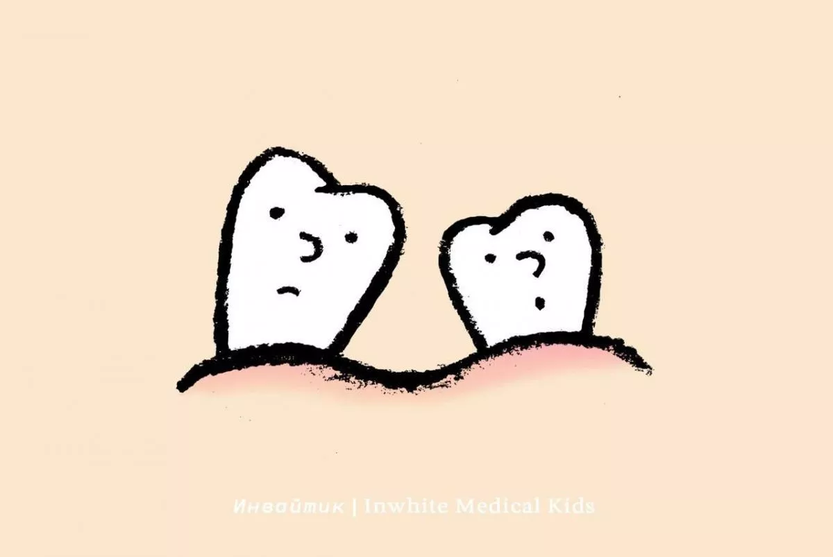 Что делать, если молочный зуб удалили раньше времени?