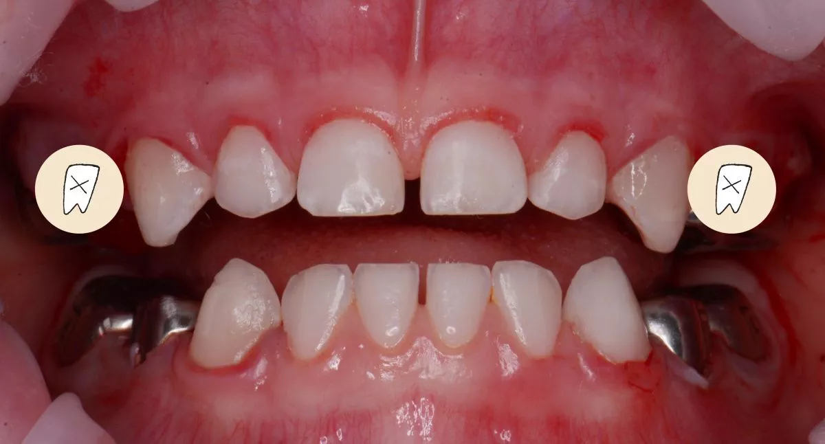 Детская стоматология наркоз Москва. Лечение во сне - установка коронок, удаление зубов и гигиена полости рта