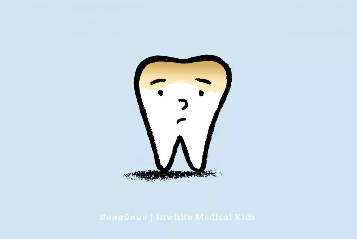 Как образуется зубной налёт?