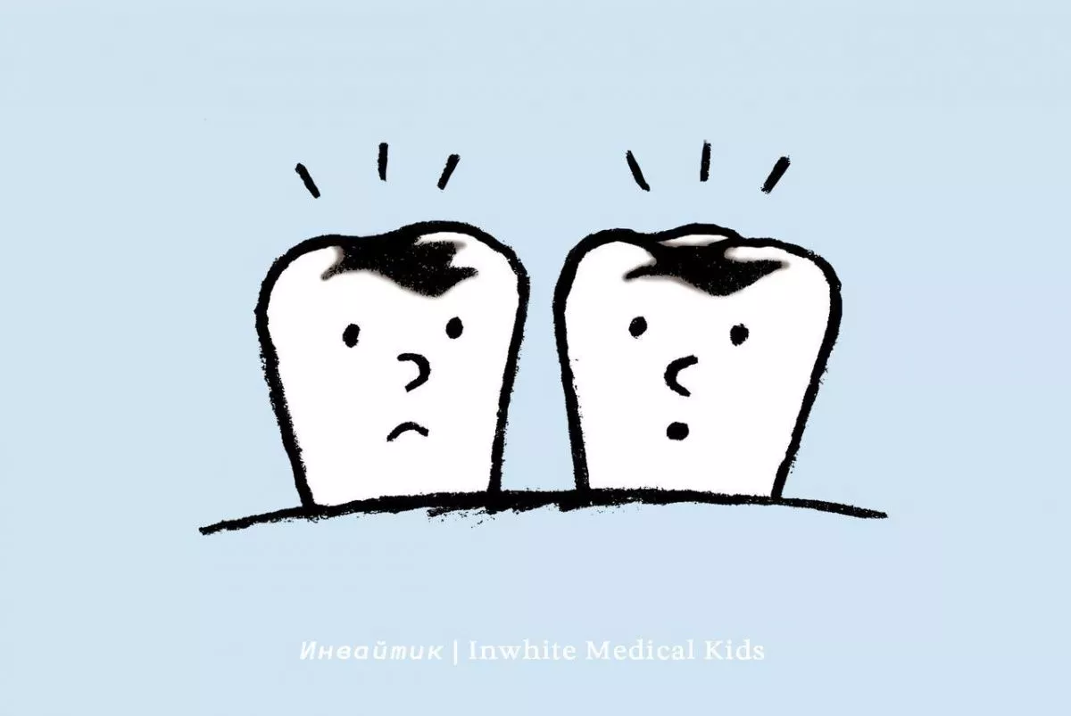 5 фактов про детский кариес