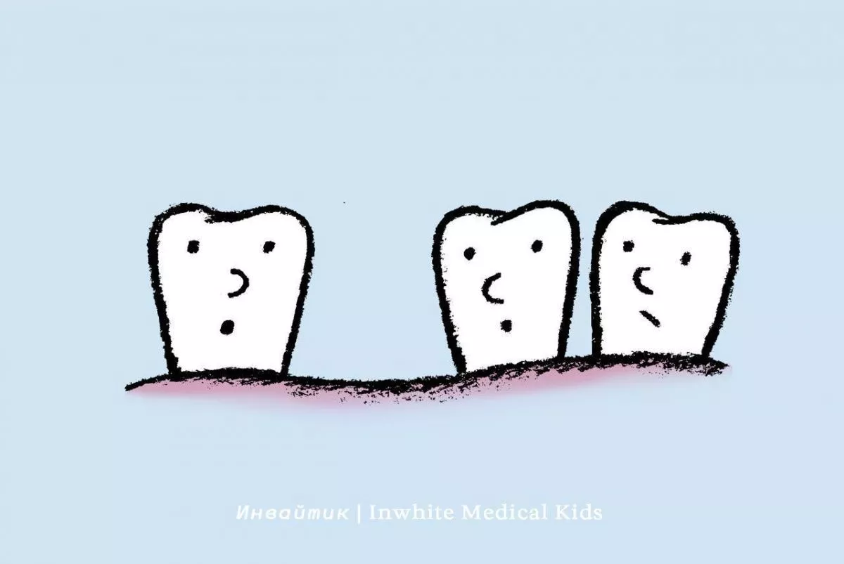 Что делать, если молочный зуб удалили раньше времени?