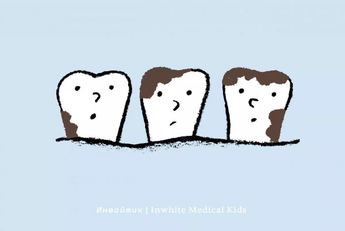 У ребёнка появился чёрный налёт на зубах. Это кариес?
