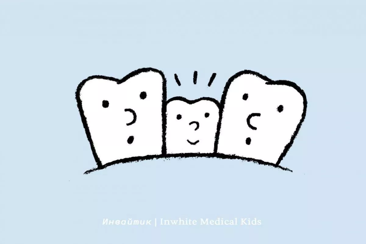 Что такое сверхкомплектные зубы?