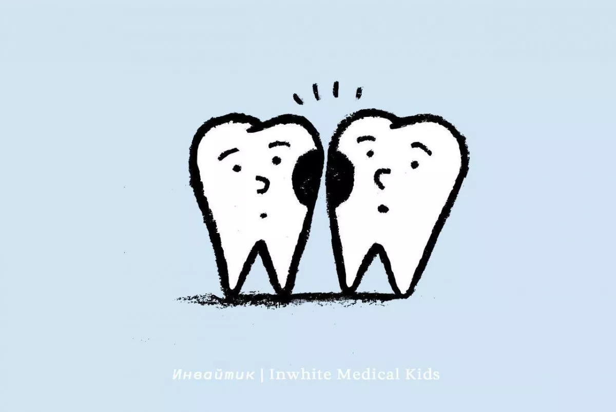 Почему у детей часто появляется кариес между зубами?