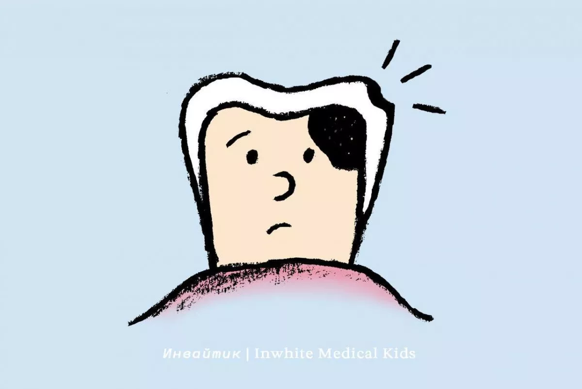 Может ли под маленькой «дырочкой» прятаться большая кариозная полость у детей?