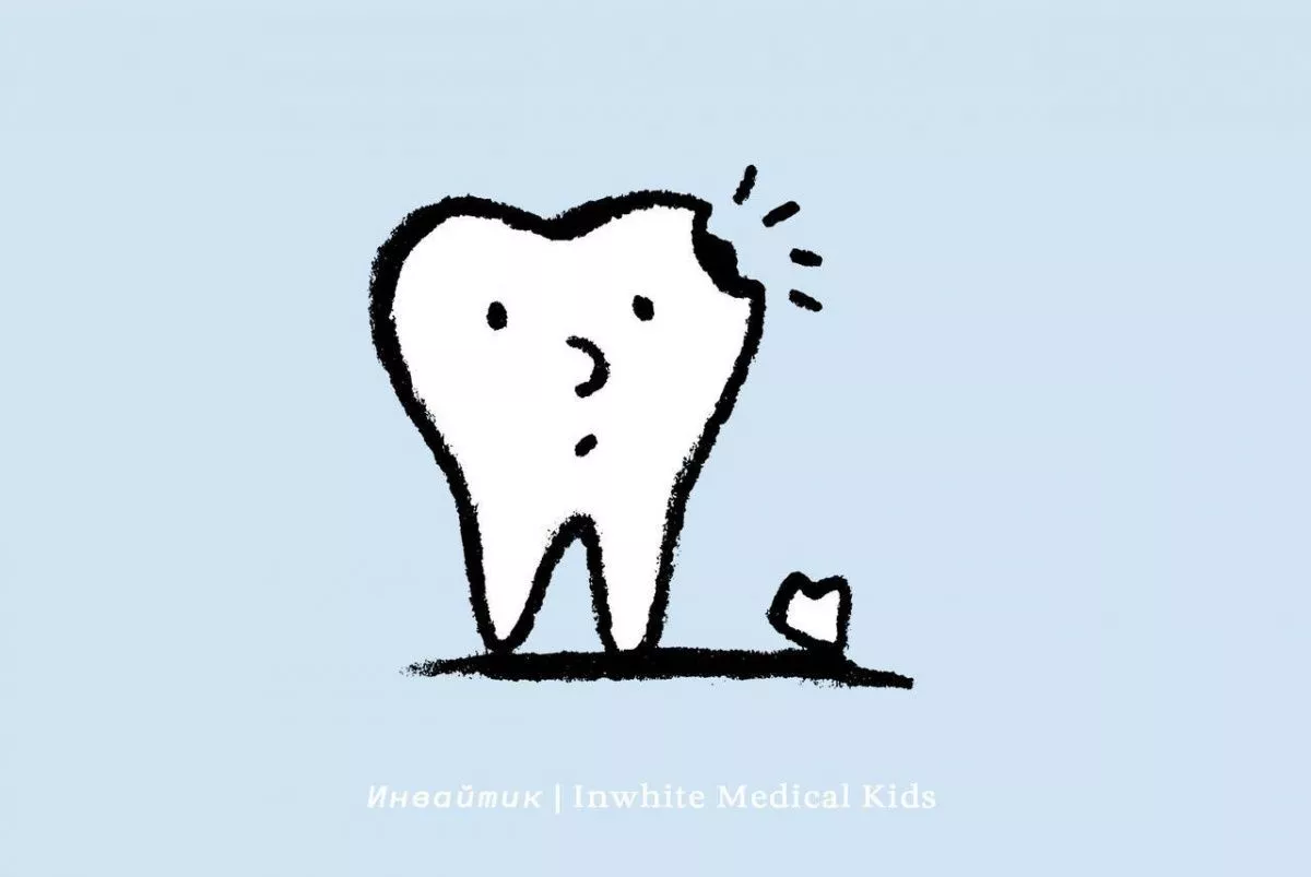 Что делать, если откололся кусочек молочного зуба?