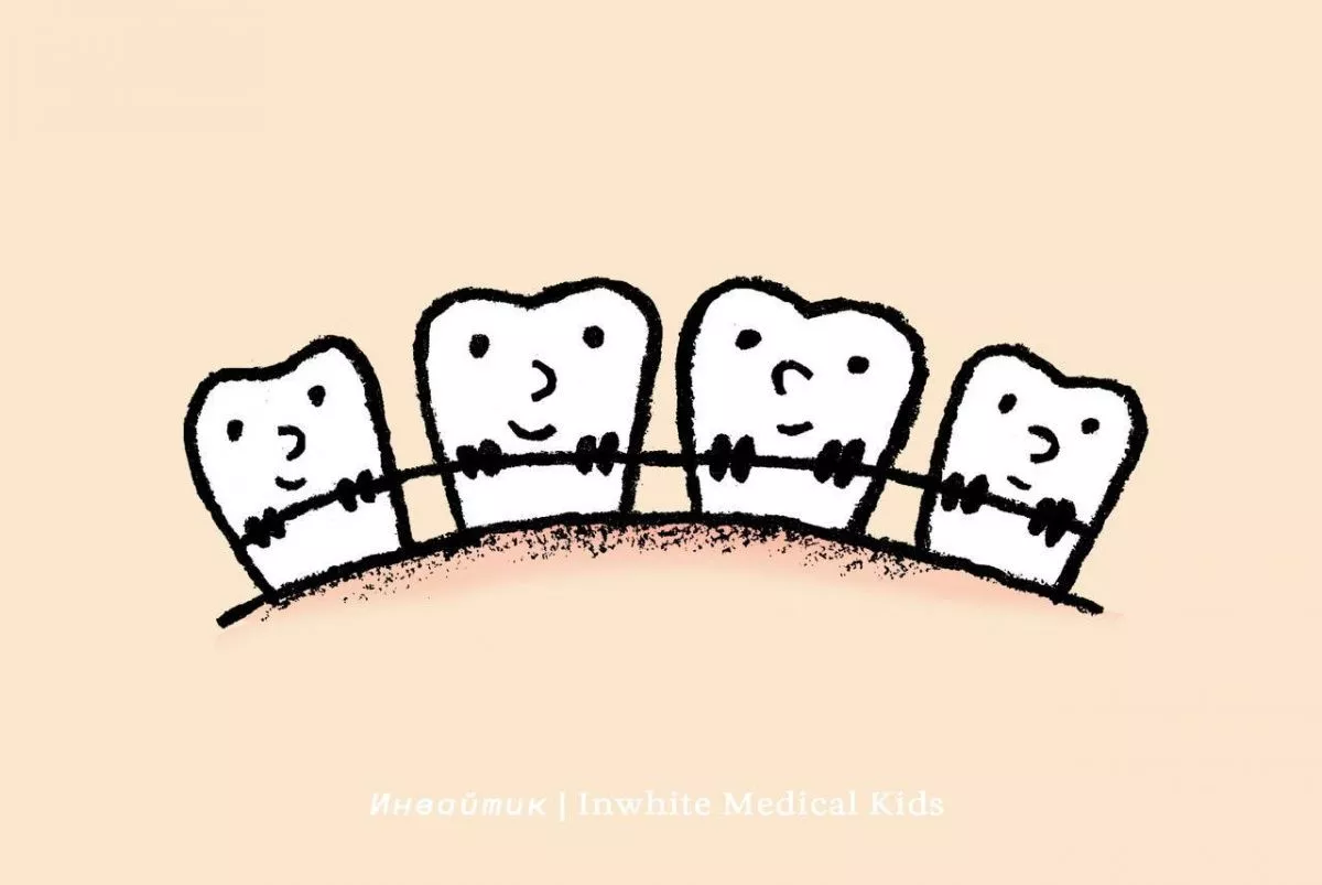 С какого возраста детям можно ставить брекеты?