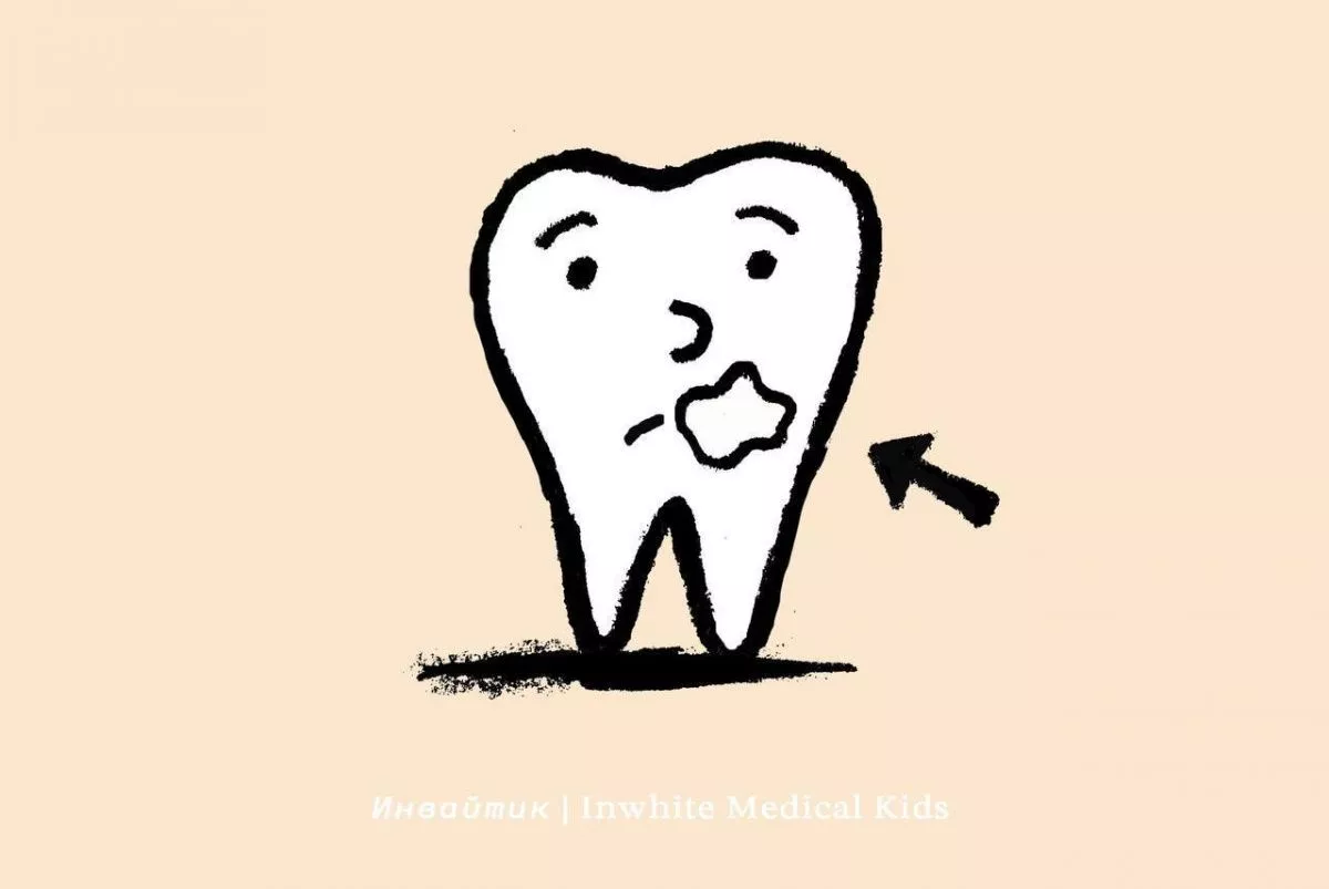 Почему у ребёнка появились пятна на зубах?
