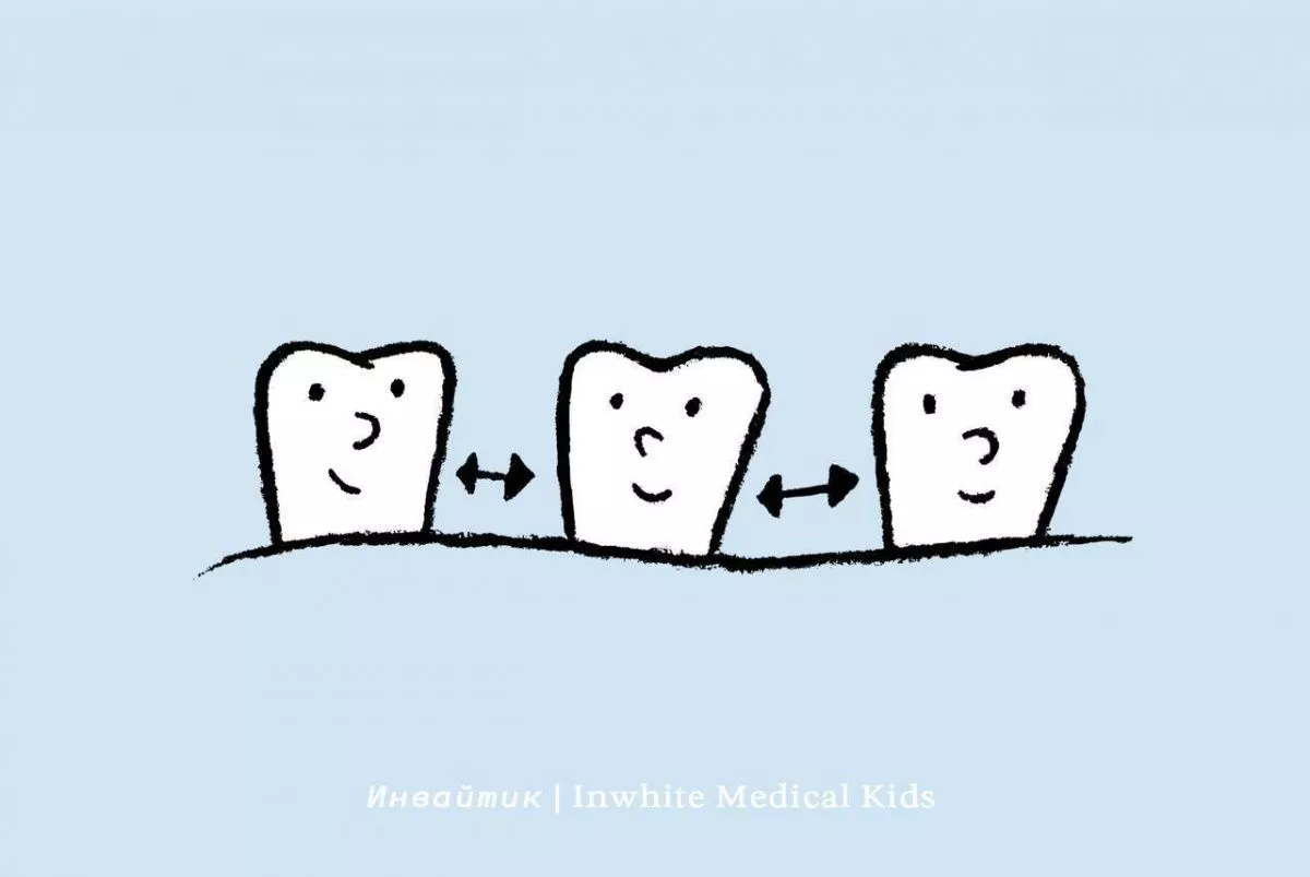 У ребёнка есть промежутки между зубами. Стоит ли переживать?