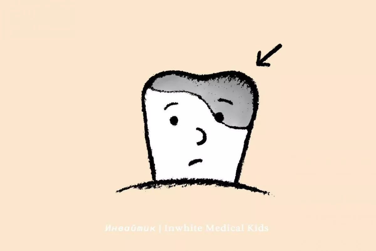 По каким причинам может выпасть пломба у ребёнка?
