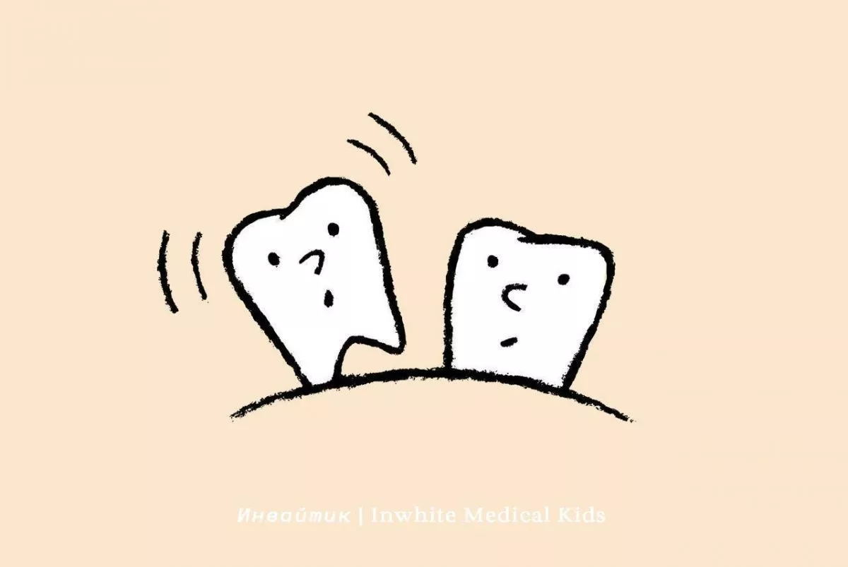 У ребёнка шатается молочный зуб. Что делать?