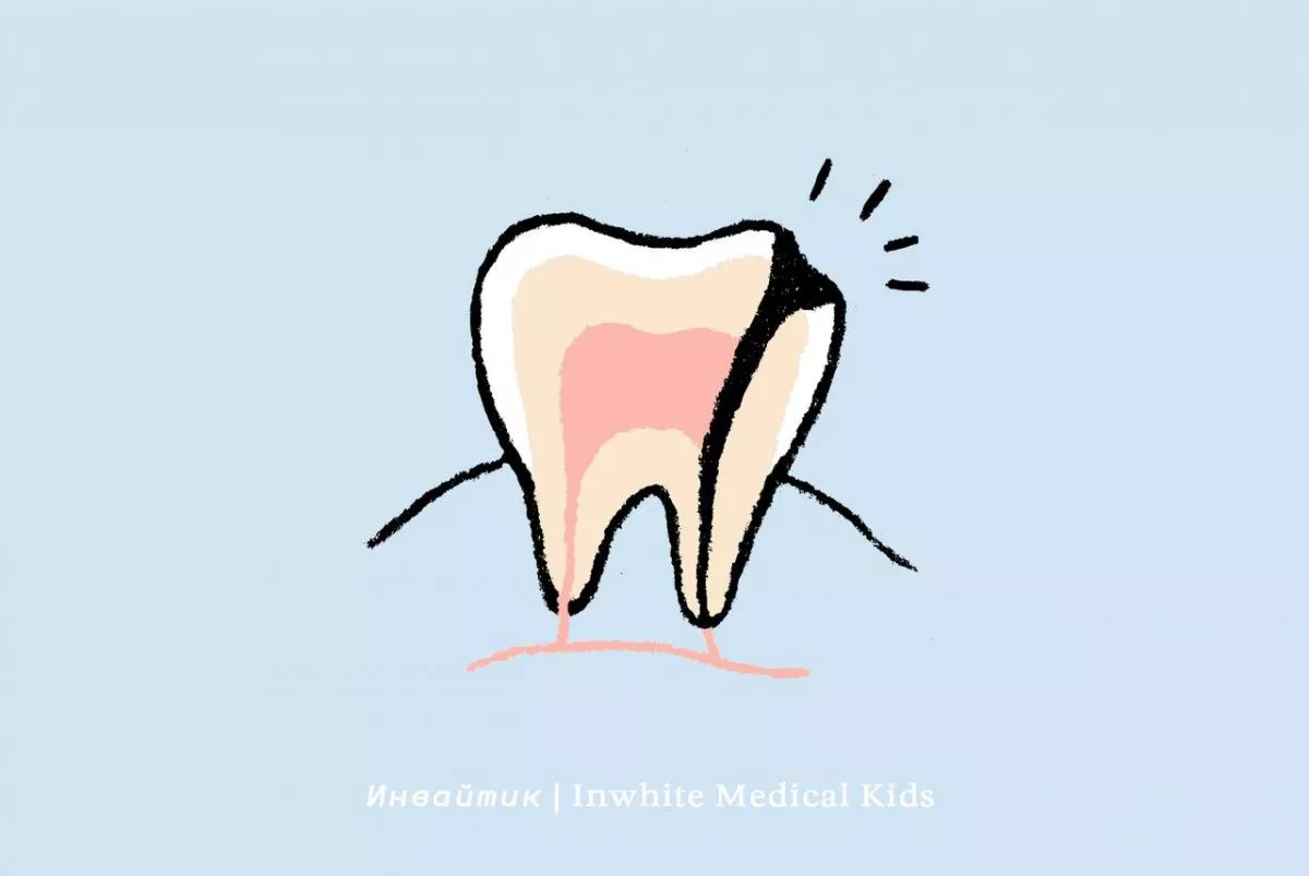 Как проходит лечение пульпита у детей?