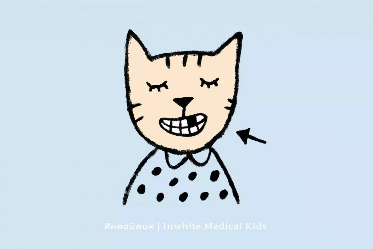 Что делать, если ребёнку выбили передний зуб?