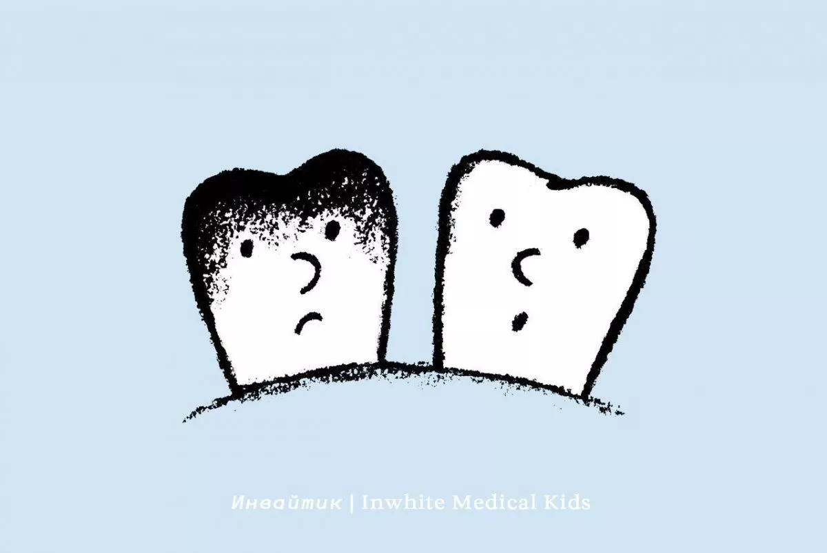 Почему у ребёнка под пломбой может появиться кариес?