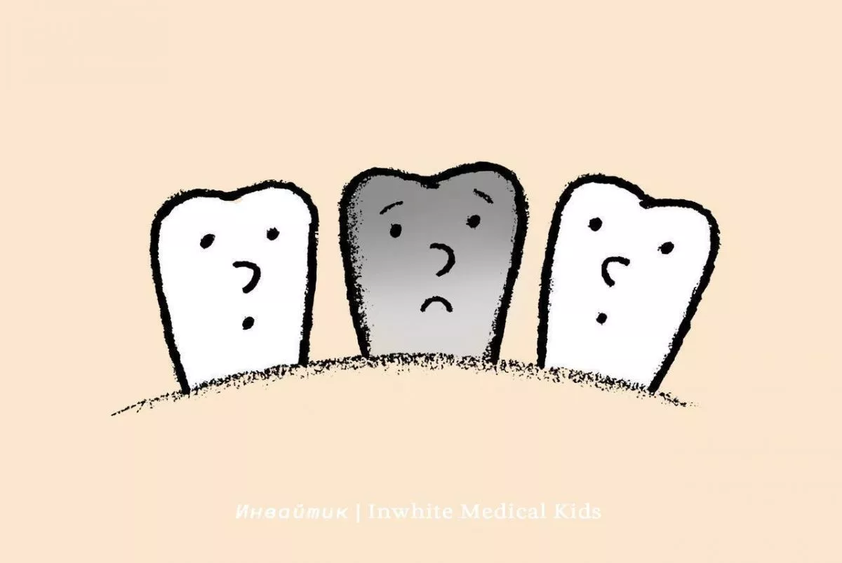 Почему у ребёнка может потемнеть зуб?