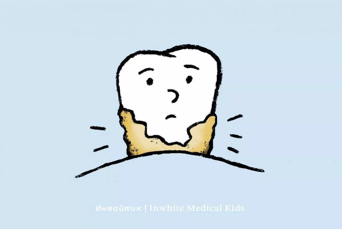 Почему у детей появляется зубной камень?