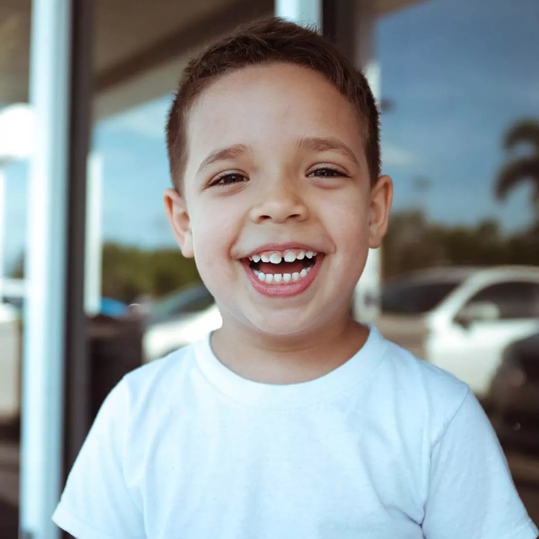 Восстановление зубов пломбами