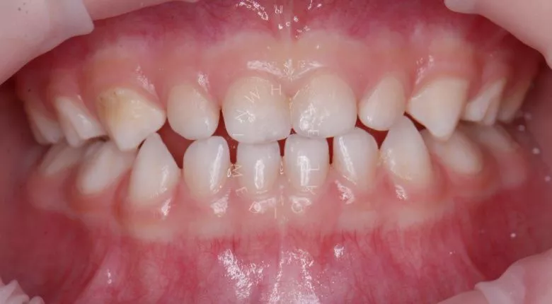  - фото до процедуры