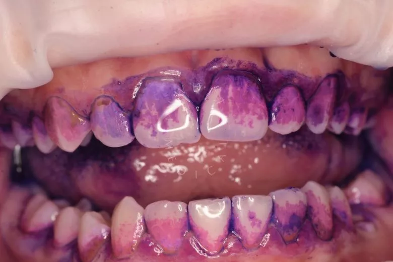  - фото до процедуры