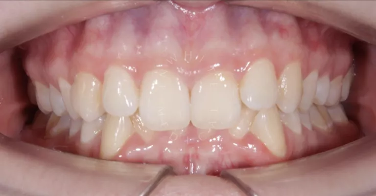 Фото до процедуры