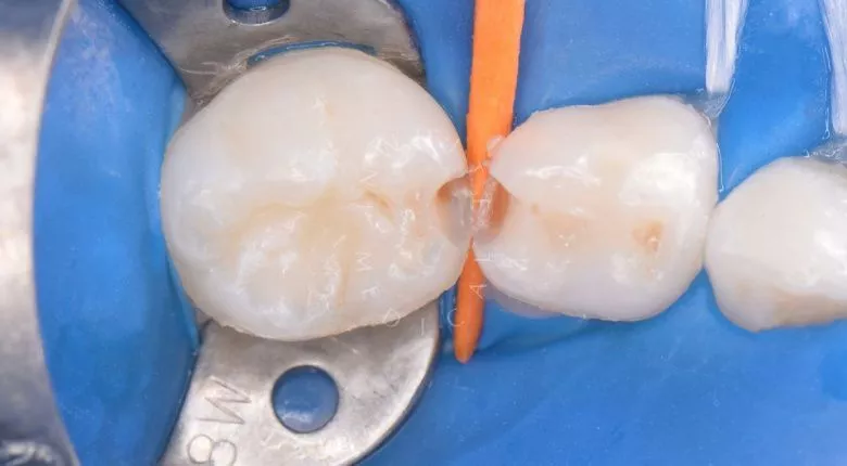  - фото до процедуры