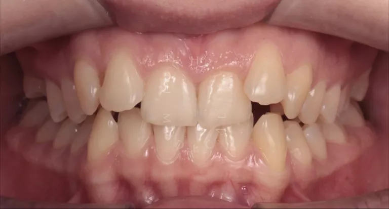 Фото до процедуры