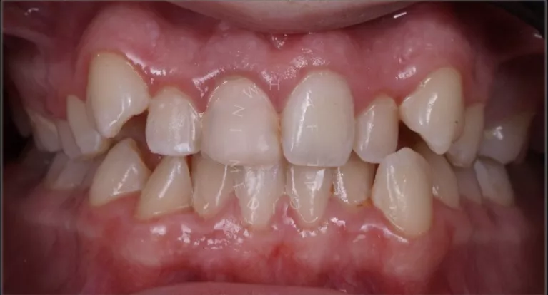 Фото до процедуры