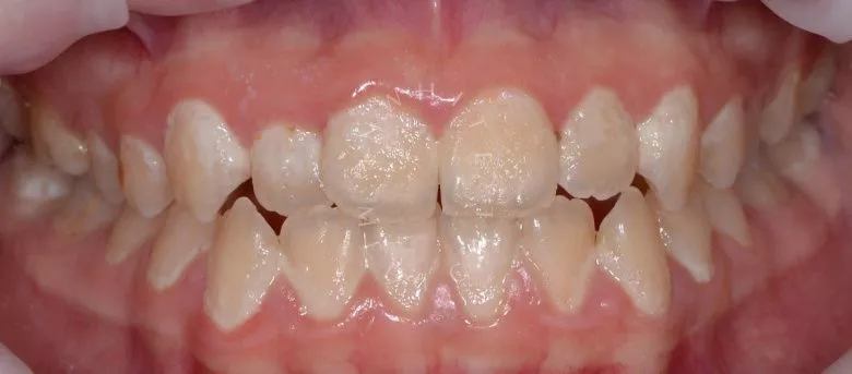  - фото до процедуры