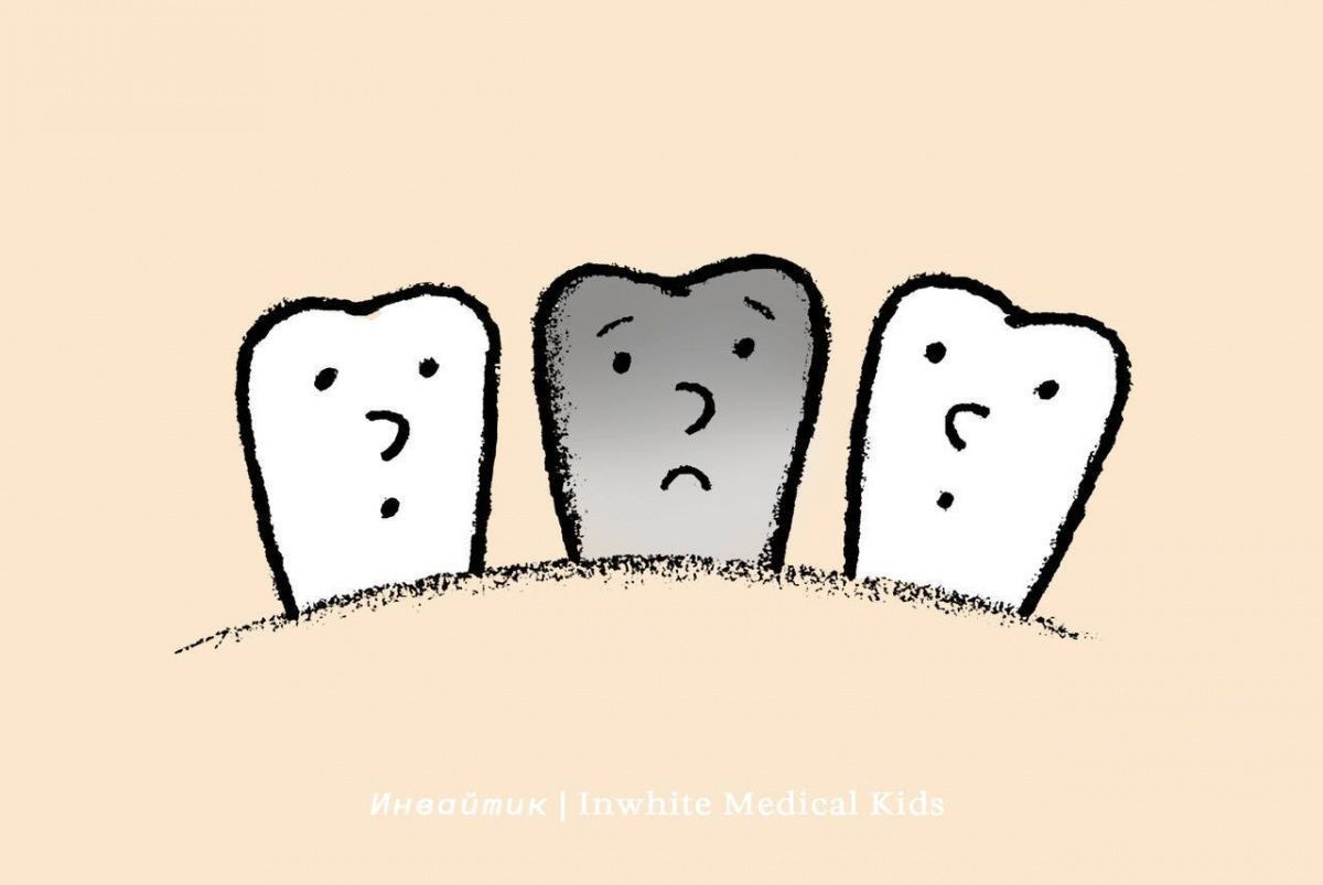 Почему у ребёнка может потемнеть зуб?