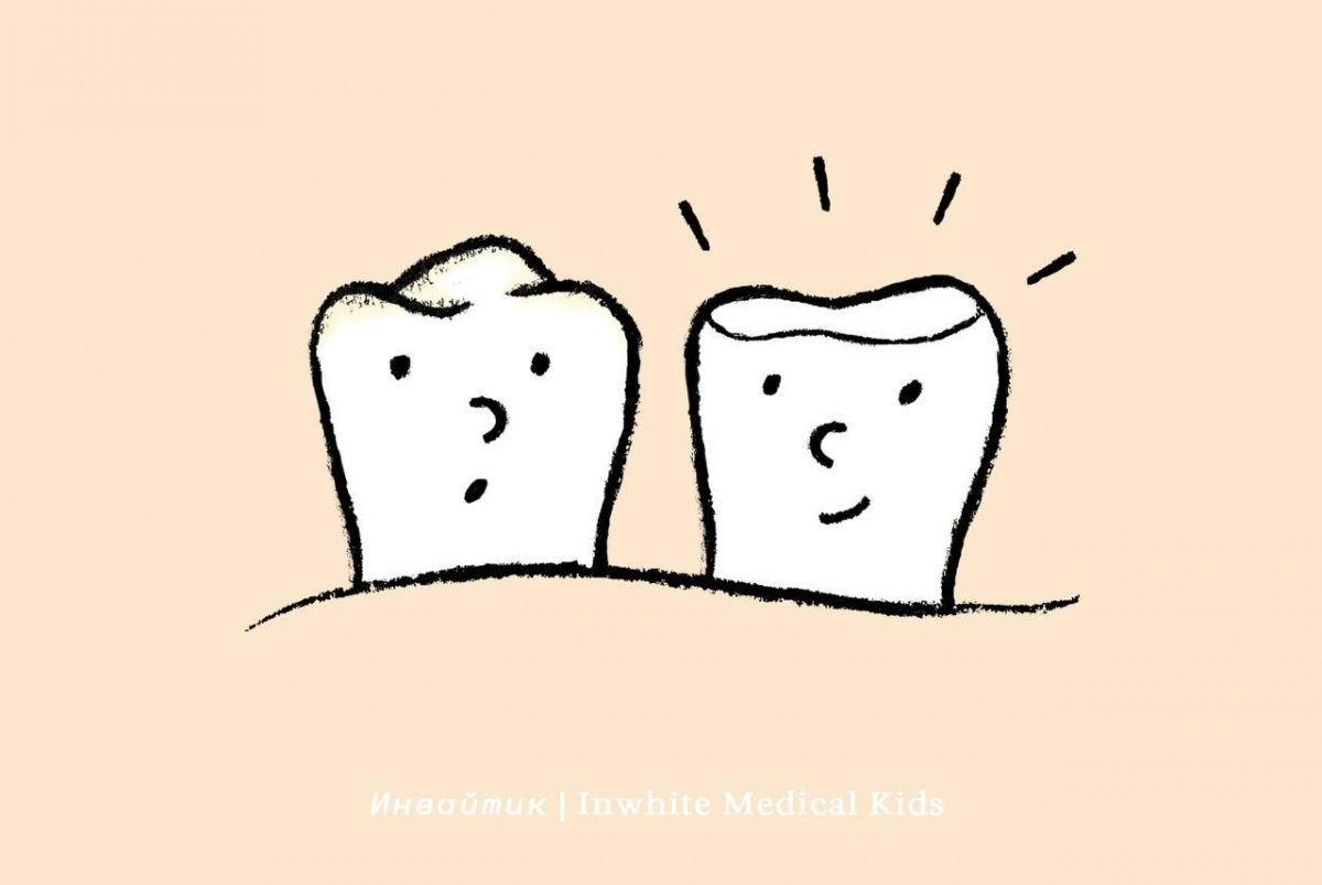 В чём отличие между художественной реставрацией и пломбой?