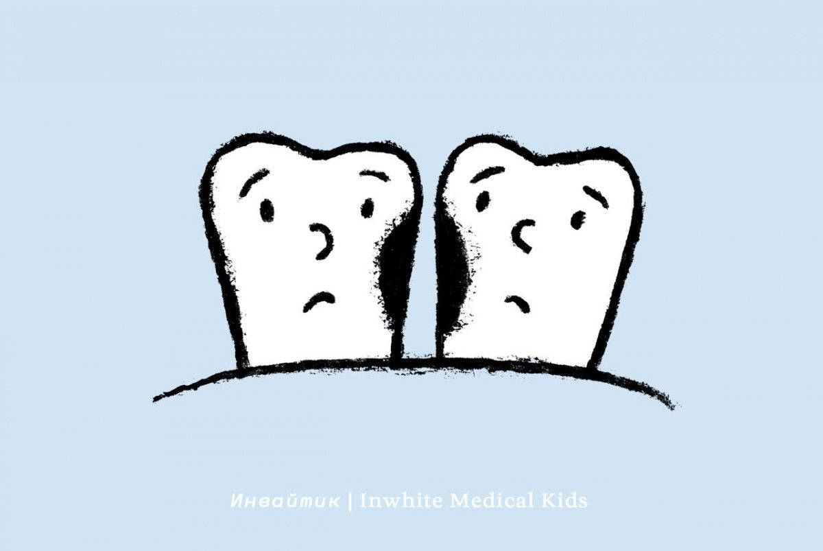 Как предупредить появление кариеса между зубами у ребёнка?