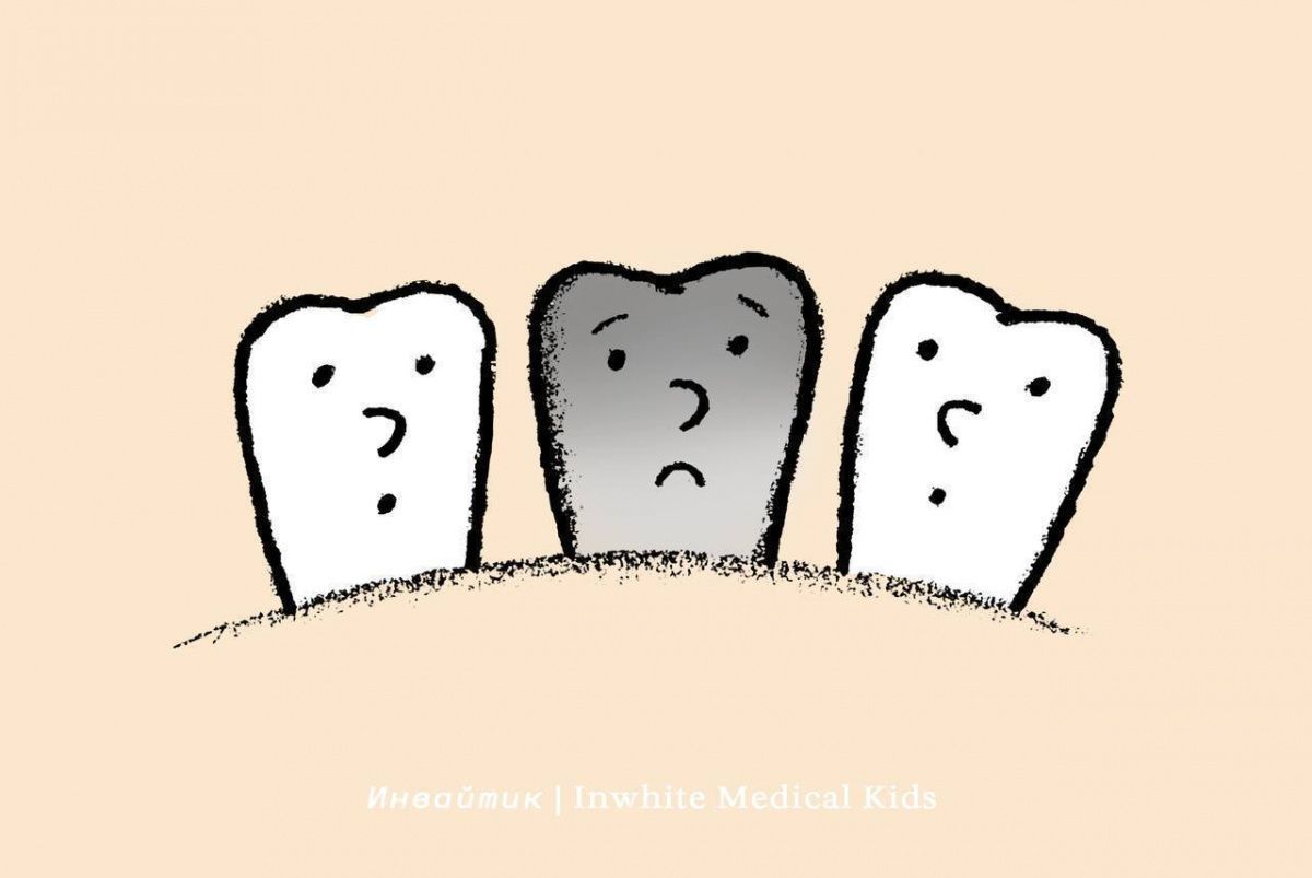 Почему у ребёнка может потемнеть зуб?