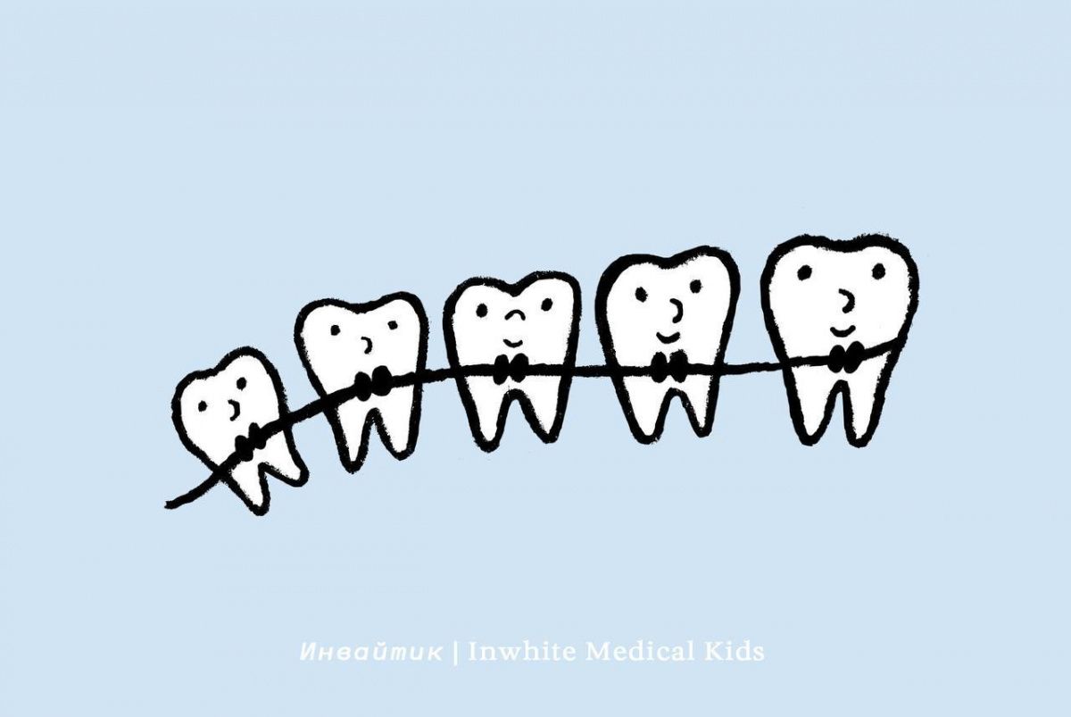 Ставят ли детям брекеты?