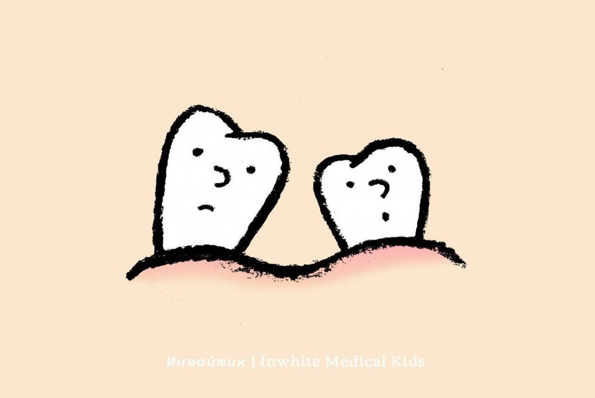 Что делать, если молочный зуб удалили раньше времени?