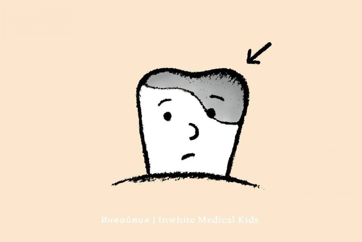 По каким причинам может выпасть пломба у ребёнка?
