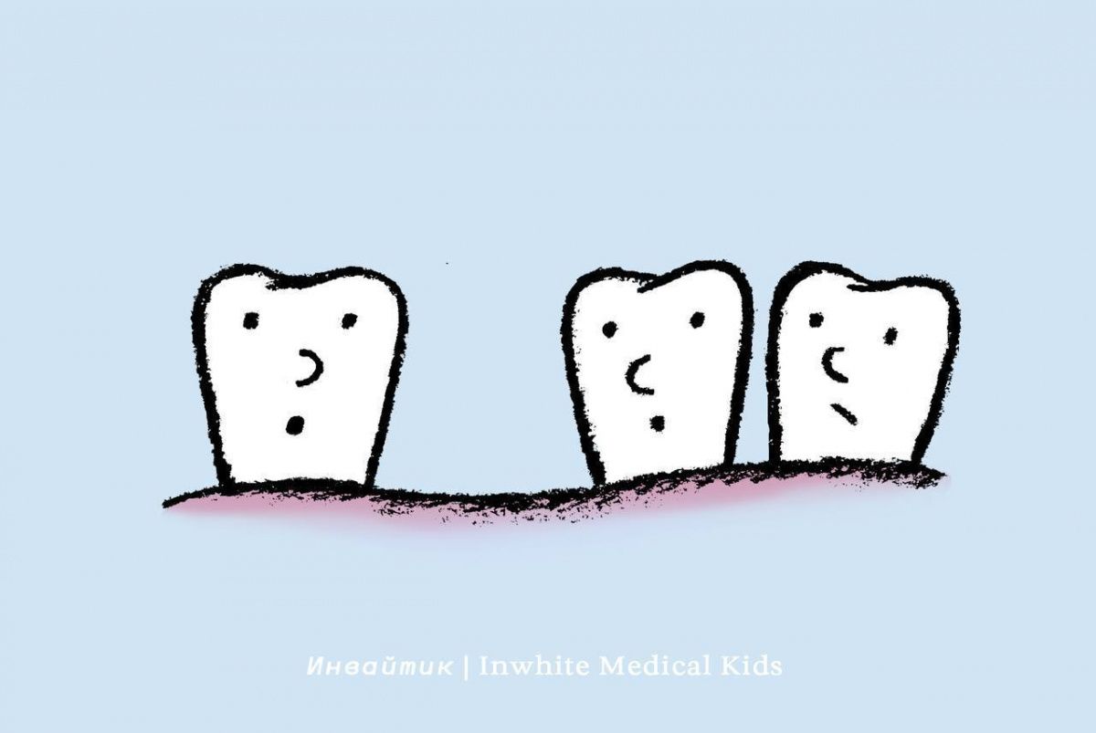 Что делать, если молочный зуб удалили раньше времени?