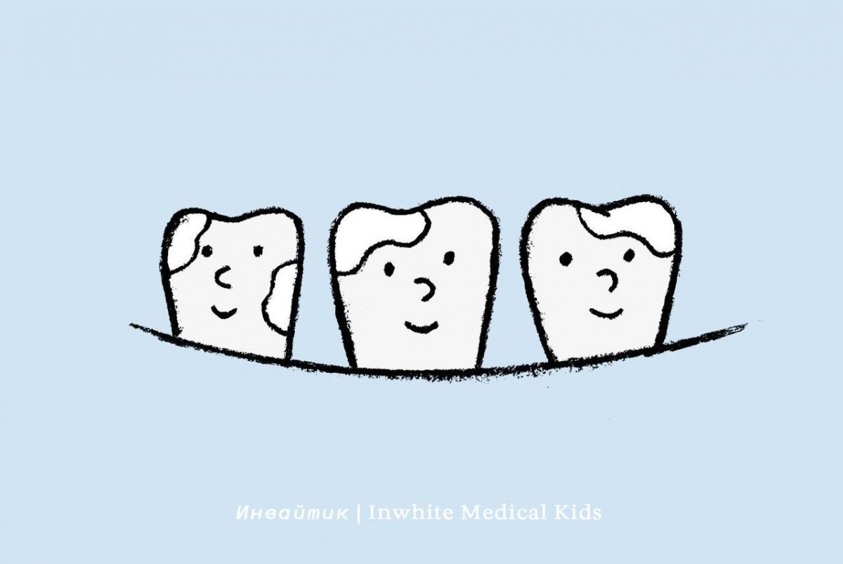 У ребёнка зубы покрыты белыми пятнами. Что это может быть?