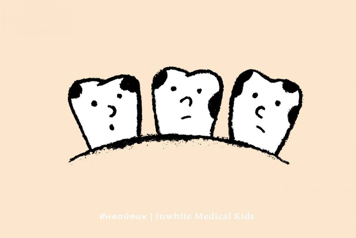 Чем опасен кариес молочных зубов?