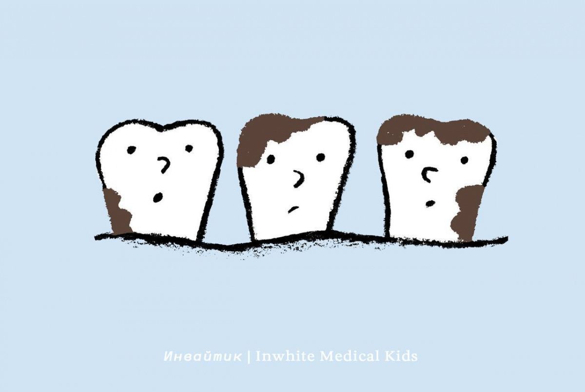 У ребёнка появился чёрный налёт на зубах. Это кариес?