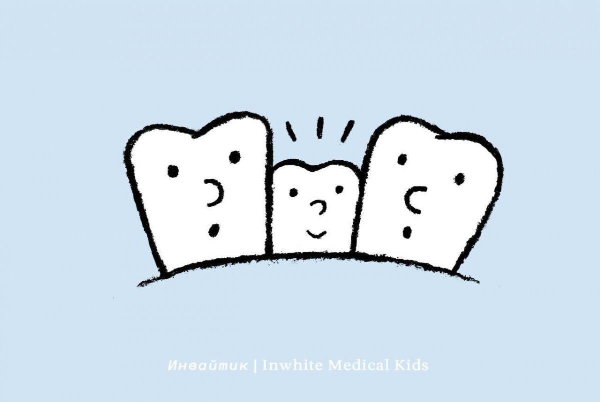 Что такое сверхкомплектные зубы?