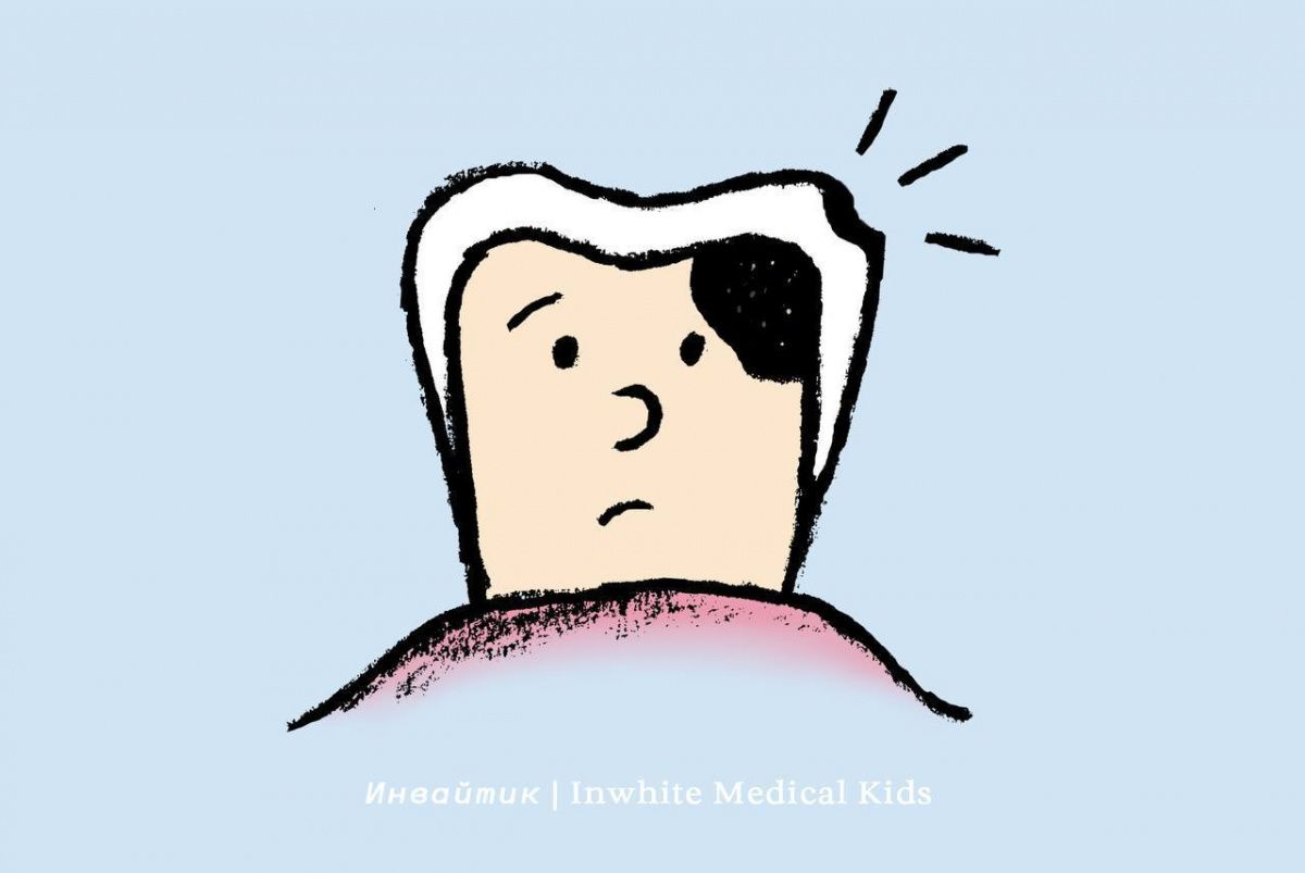 Может ли под маленькой «дырочкой» прятаться большая кариозная полость у детей?