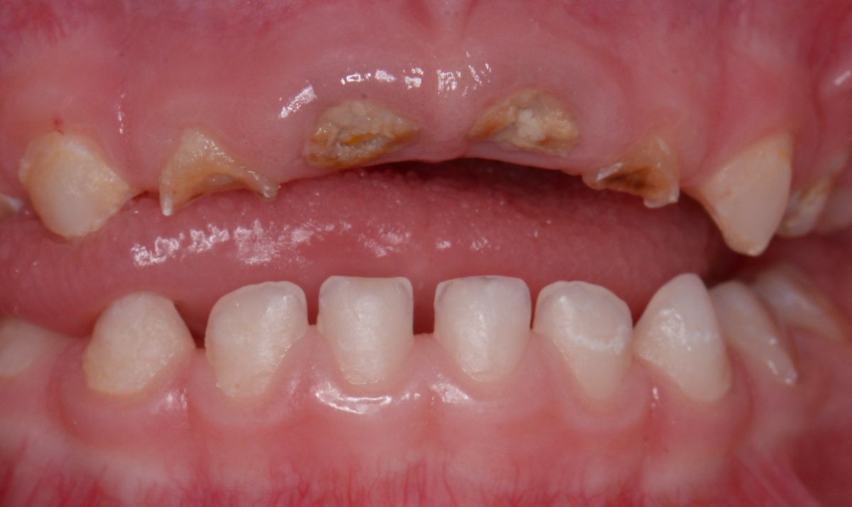  - before the procedure