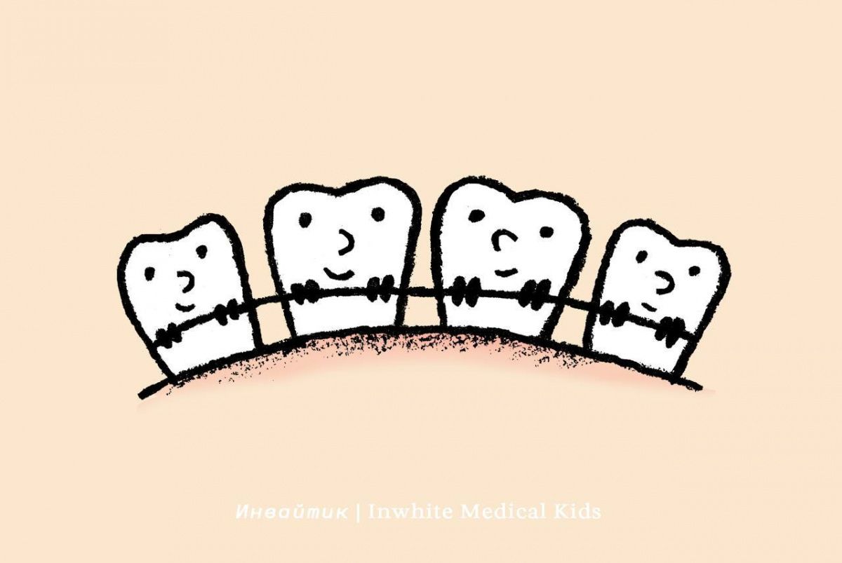 С какого возраста детям можно ставить брекеты?