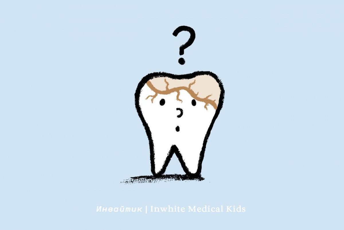 Почему у ребёнка может появиться кариес под пломбой?