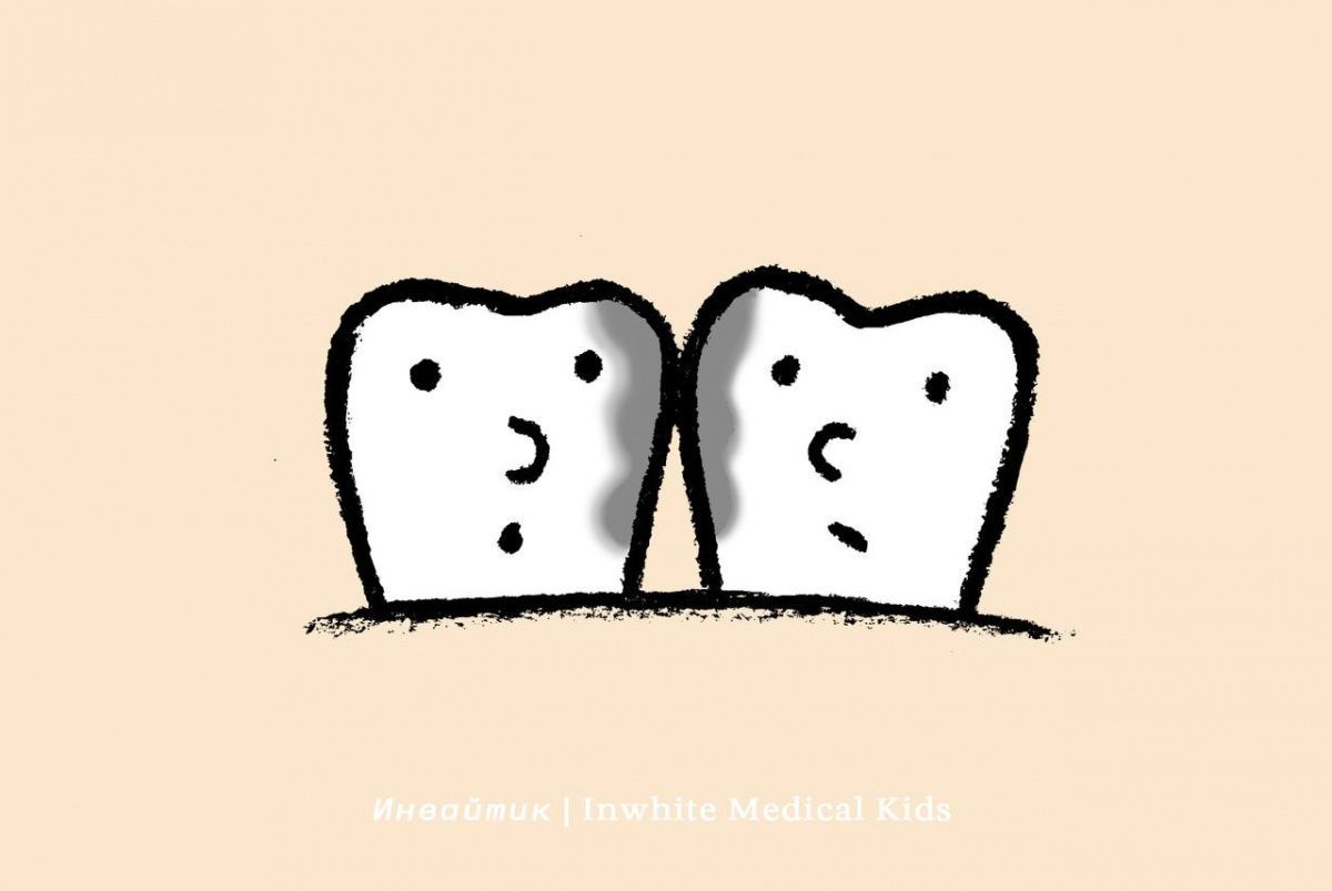 Что такое скрытый кариес и где он появляется?