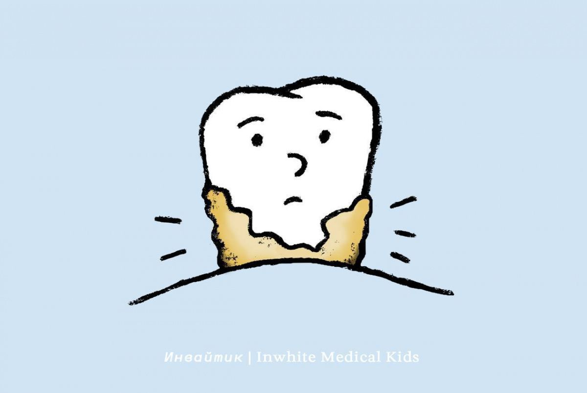 Почему у детей образуется зубной камень?