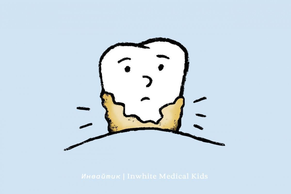 Почему у детей появляется зубной камень?  