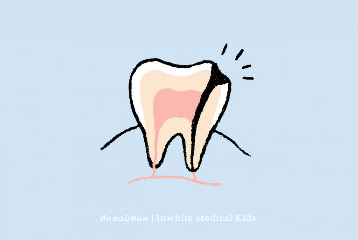 Как проходит лечение пульпита у детей?